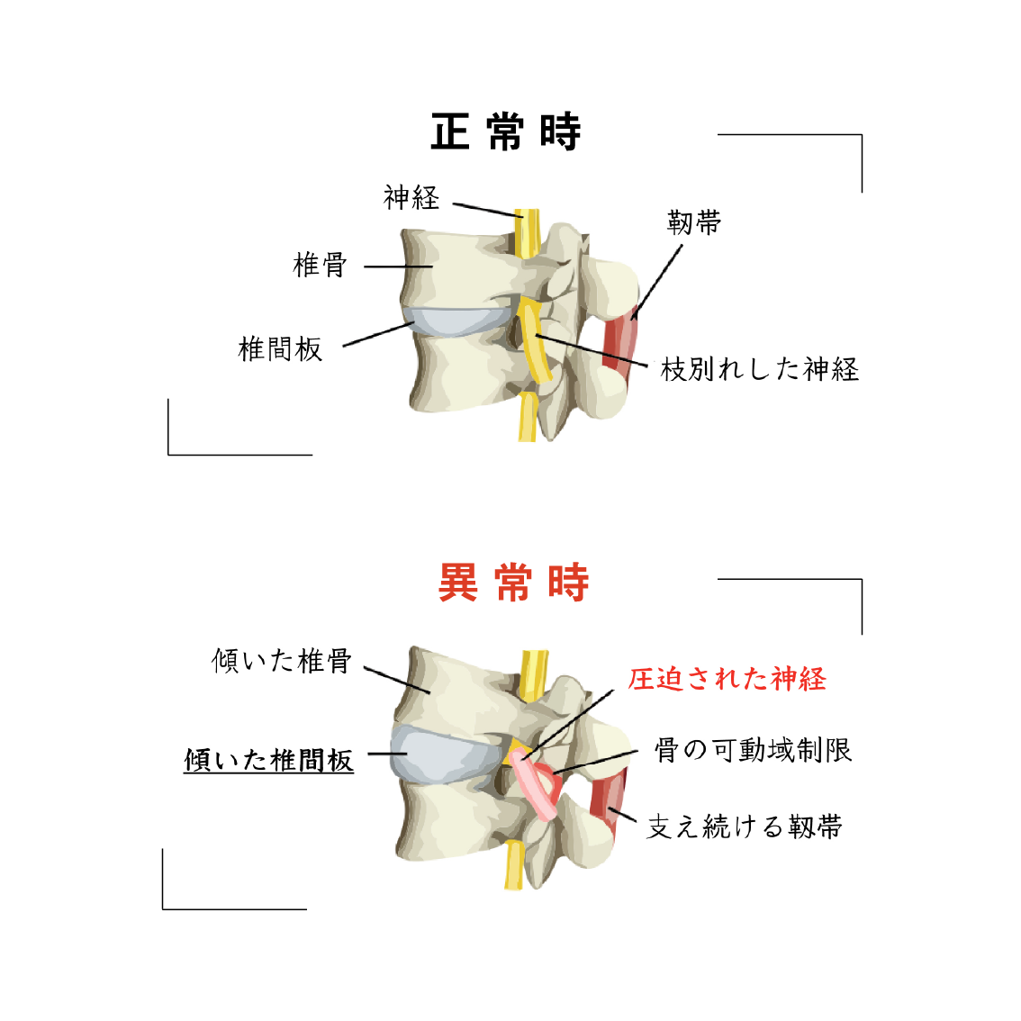 椎間板と神経の関係